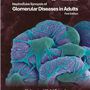 NephroTube Synopsis of Glomerular Diseases in Adults PDF