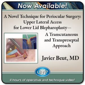 2024 A Novel Technique for Periocular Surgery: Upper Lateral Access for Lower Lid Blepharoplasty – A Transcutaneous and Transpreseptal Approach QMP
