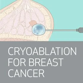 Houston Methodist Advanced Interventional Breast Imaging: Cryoablation, CEM, MRI, Stereotactic and Ultrasound Guidance 2025