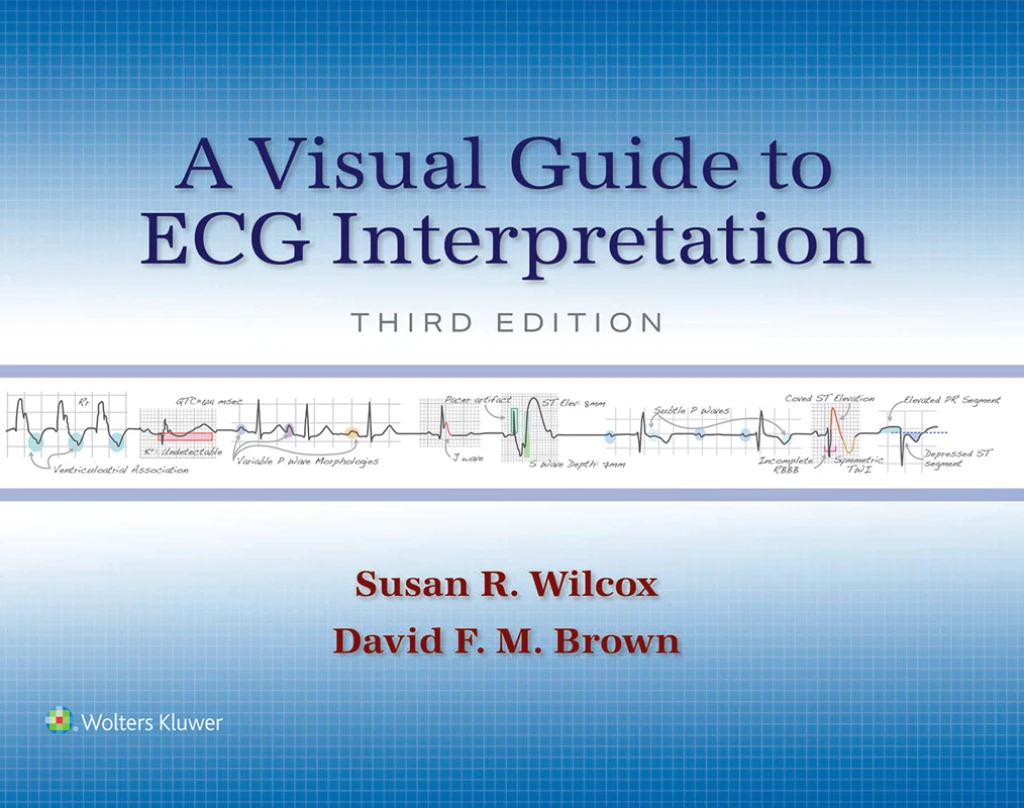 A Visual Guide To ECG Interpretation, 3rd Edition (EPUB)