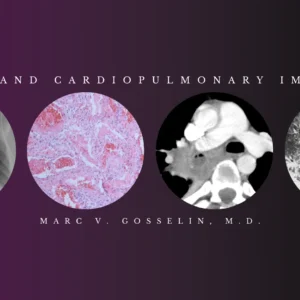 CMEScience Chest and Cardiopulmonary Imaging – Marc V. Gosselin, M.D (Videos + PDF)