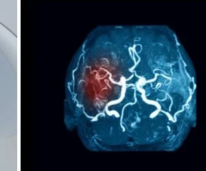 Harvard Neurological Emergencies 2025 (Videos + Slides PDFs)