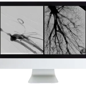 ARRS Case Review of Vascular and Interventional Radiology 2023 (Videos)