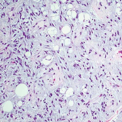 Oakstone Cleveland Clinic Comprehensive and Immersive Soft Tissue Pathology 2025