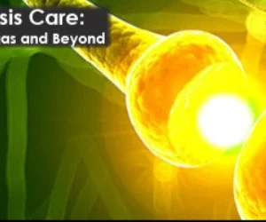 Cleveland Clinic Unveiling Comprehensive Multiple Sclerosis Care 2024