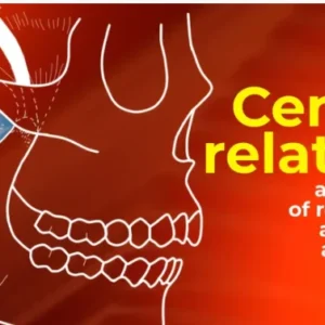 OHI-S Centric relation all methods of registration and clinical application