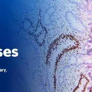 The Pathology of Neoplastic Diseases 2024