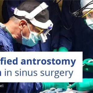 Osteocom – Simplified Antrostomy Design in Sinus Surgery – Tiziano Testori